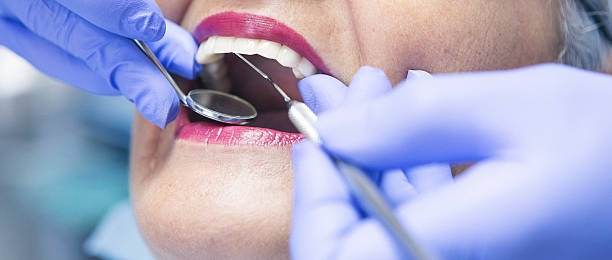 Best Emergency Wisdom Teeth Removal in Gunbarrel, CO